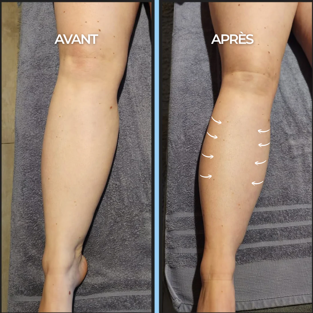 Compression Socks - Maison Lys