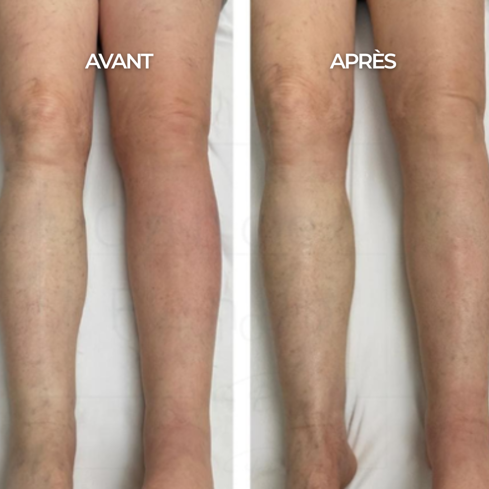 Compression Socks - Maison Lys