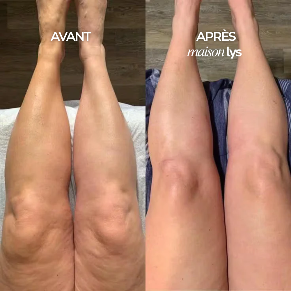 Lymphatic Drainage Wellness Drops